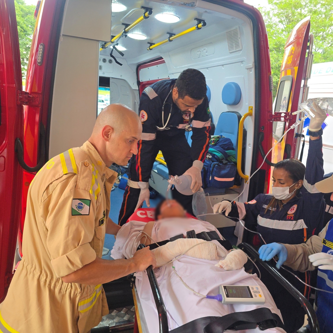 Mulher sofre queimaduras em mais de 80% do corpo ao acender réchaud de buffet