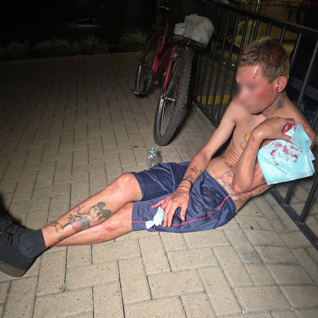 Rapaz é agredido e esfaqueado durante roubo em Maringá