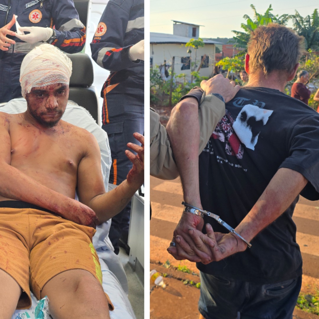 Discussão termina com jovem ferido por golpes de faca na cabeça em Sarandi
