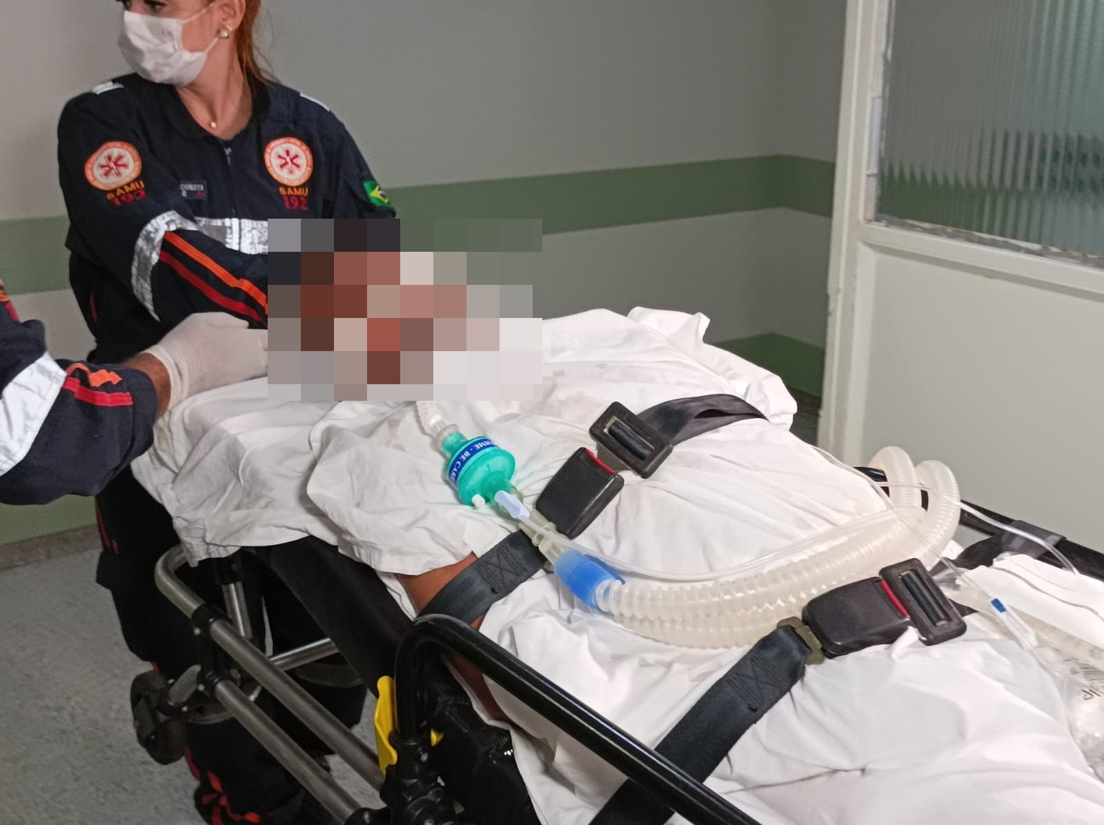 Homem sofre queimaduras em 25% do corpo ao tentar acender churrasqueira